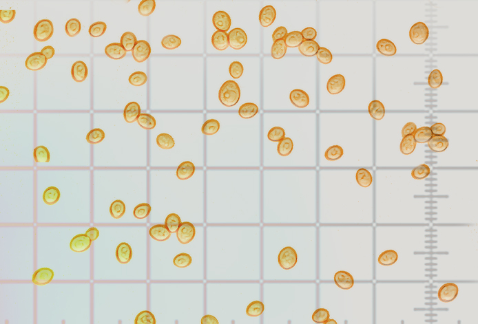 CELL COUNTING YOUR YEAST CULTURE